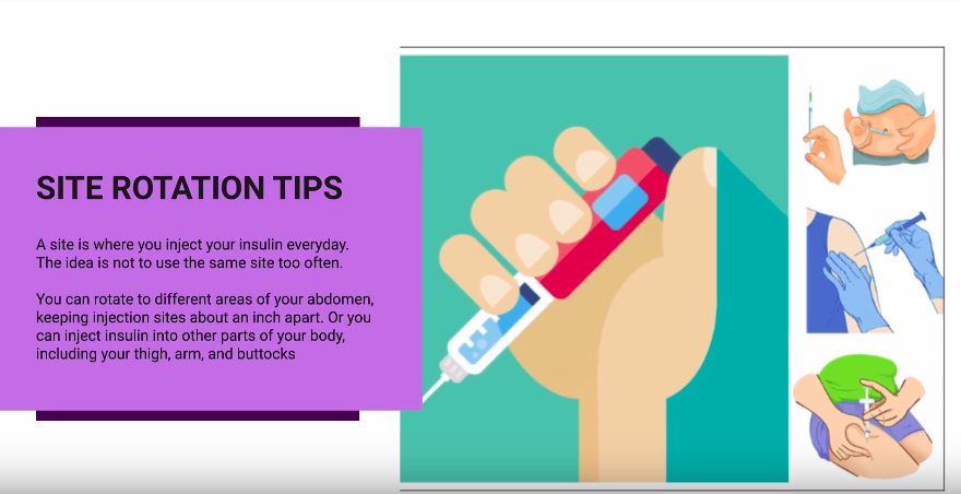 Insulin Injection Sites By SAATH7CONNECT Lybrate