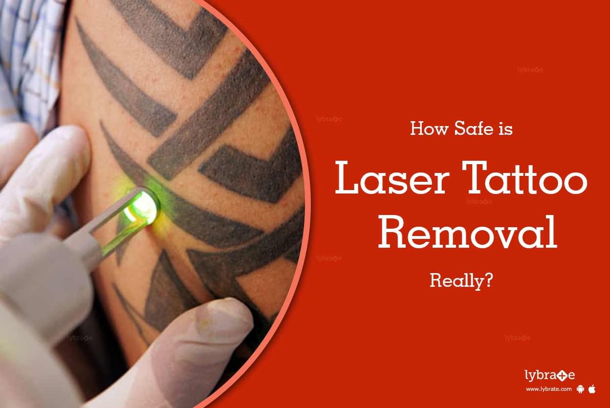 How Safe is Laser Tattoo Removal, Really? - By Dr. Jolly Shah Kapadia |  Lybrate