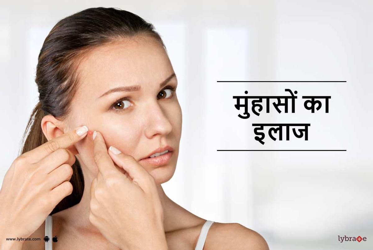 pimple-treatment-in-hindi-by-dt-radhika-lybrate