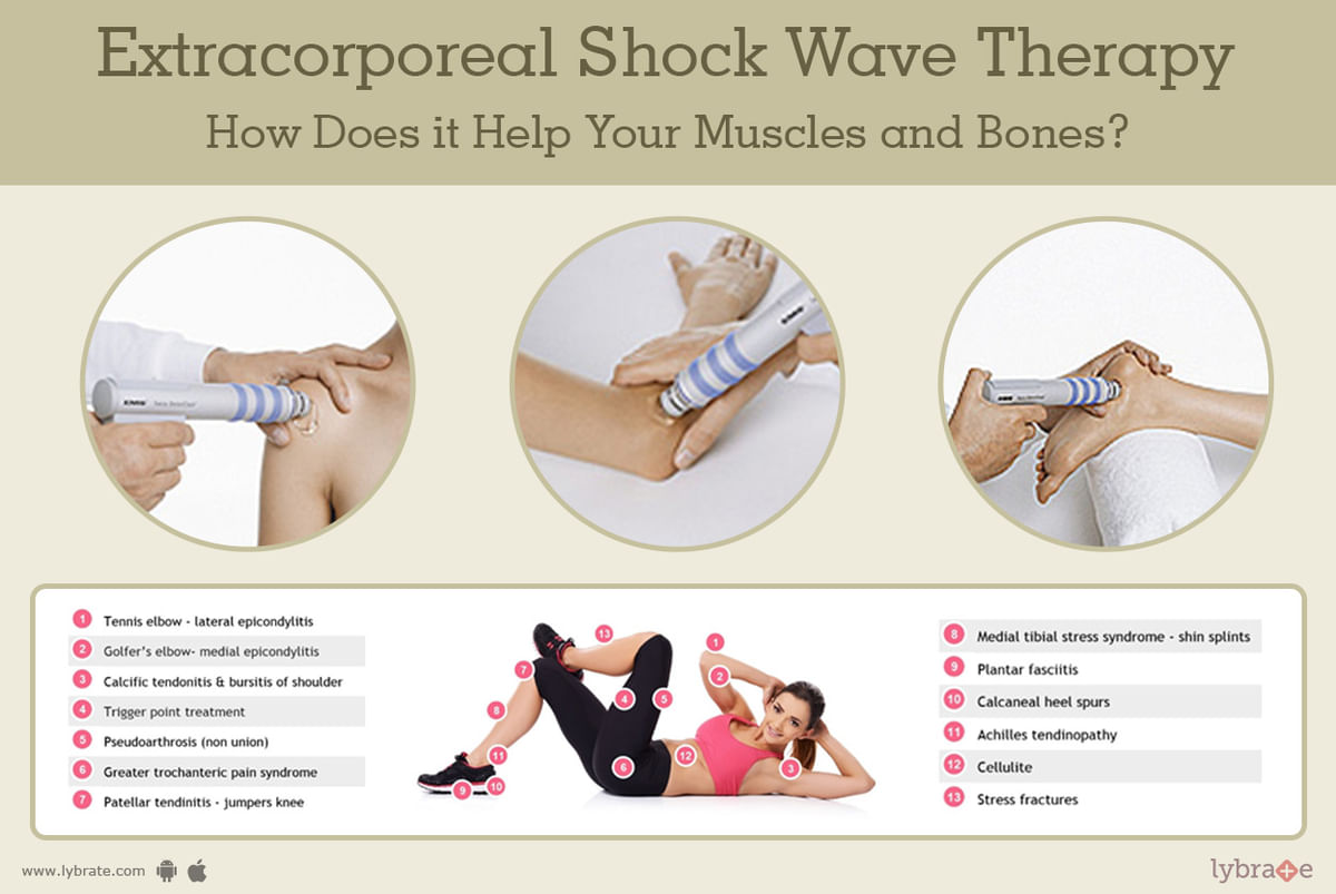 Extracorporeal Shock Wave Therapy: How Does it Help Your Muscles
