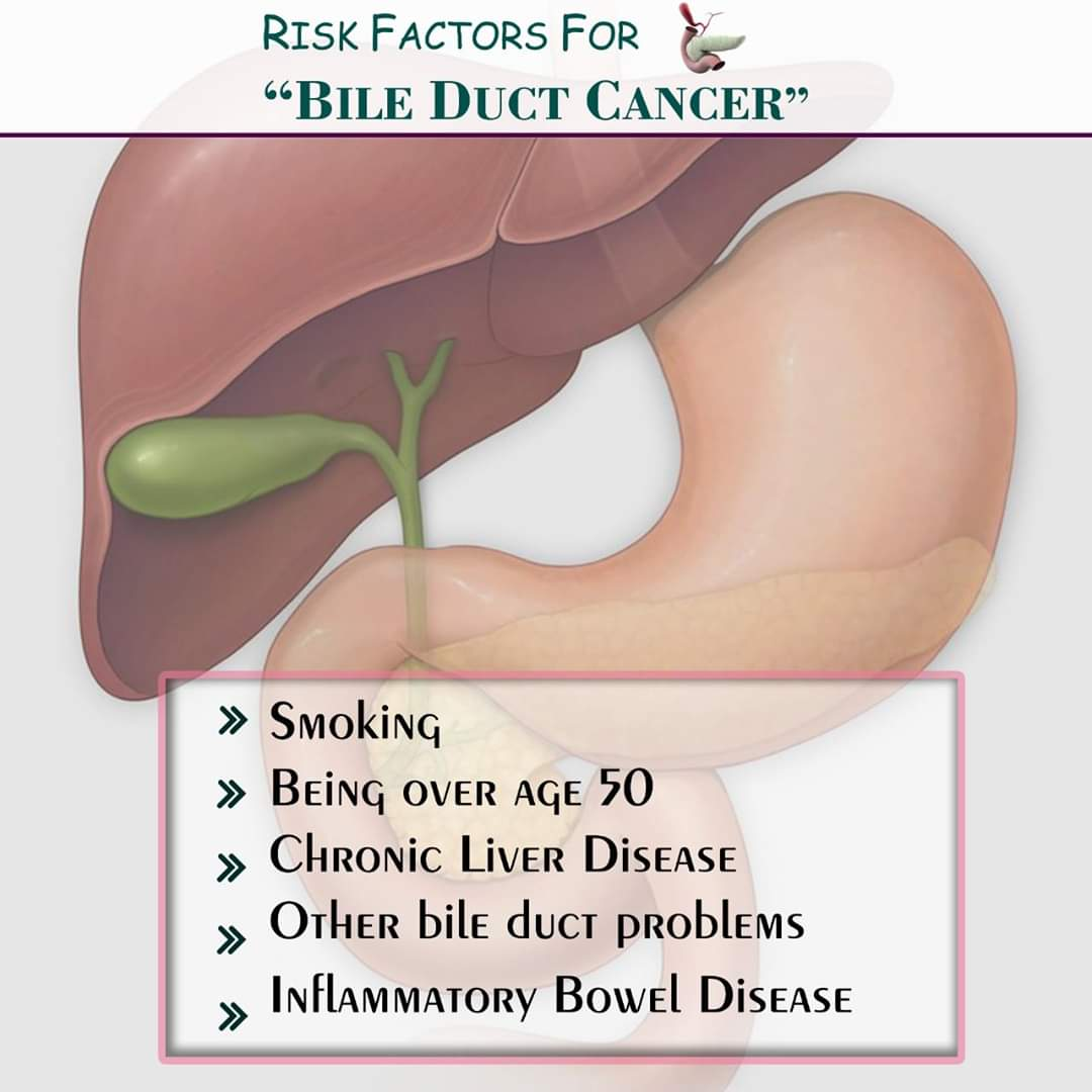 Risk Factors Of Bile Duct Cancer By Dr Nikhil Agrawal Lybrate 3366