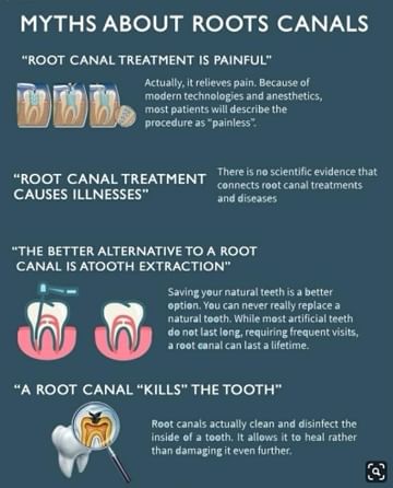 Debunking Myths Around Root Canal Treatment! - By Dr. Manasvi Behl ...