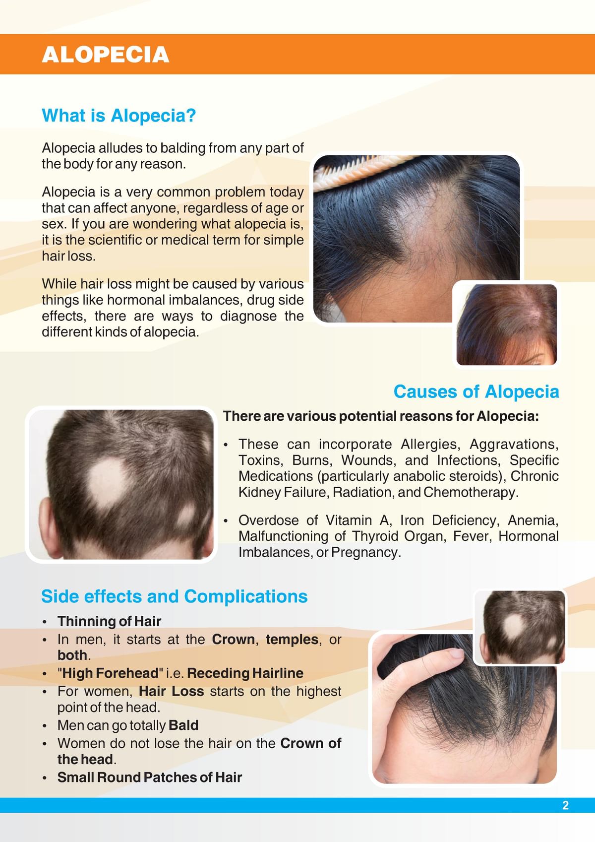 List of hair diseases - Detailed notes - Examining major diseases in daily  life 'Hair loss Alopecia' - Studocu