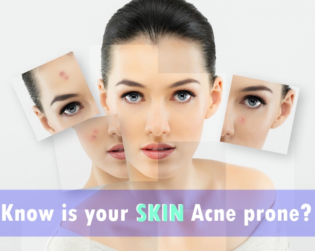 How to Know If Your Skin is Acne Prone By Dr. X Lybrate