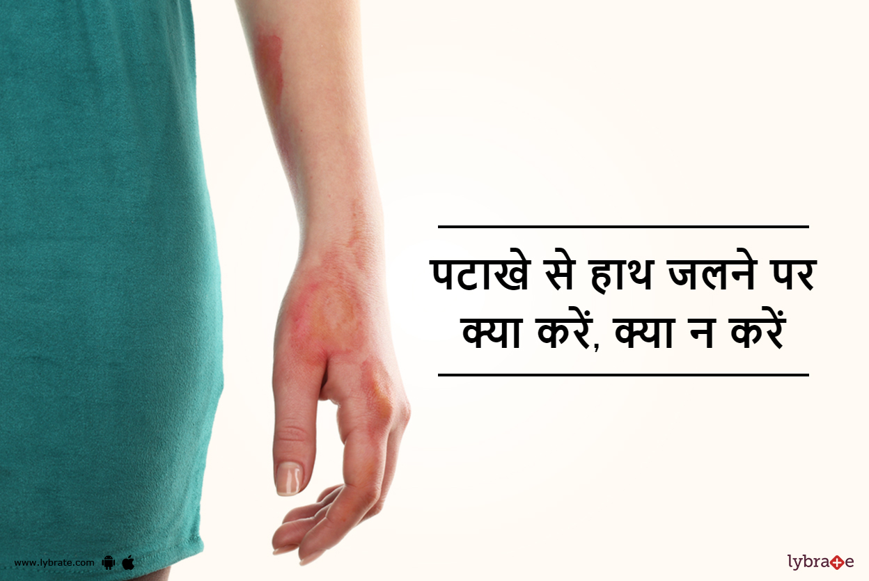 पटाखे से हाथ जलने पर क्या करें, क्या न करें Pathake Se Haath Jalne Par Kya Kare Kya Naa Kare