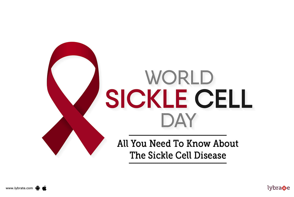 World Sickle Cell Day All You Need To Know About The Sickle Cell