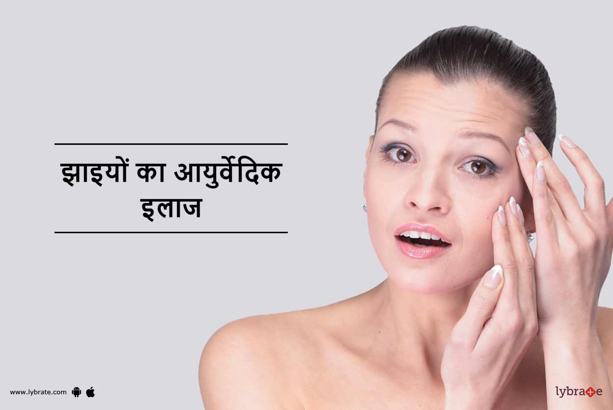 झाइयों का आयुर्वेदिक इलाज Jhaiyon Ka Ayurvedic Ilaj in Hindi