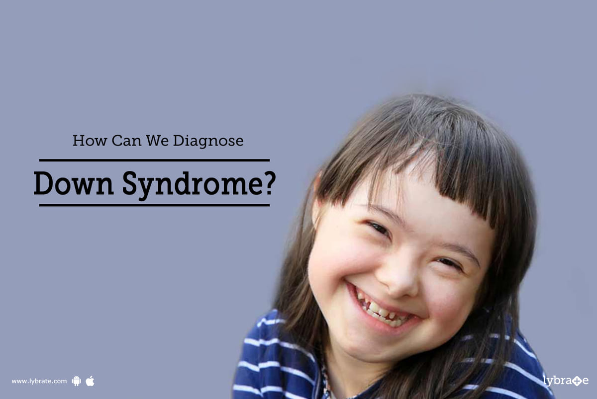 How Can We Diagnose Down Syndrome? - By Dr. Sanjeev Kumar Singh | Lybrate