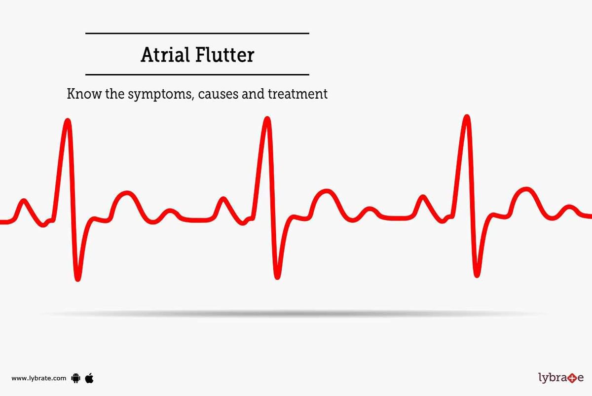 Atrial Flutter Know The Symptoms Causes And Treatment By Dr