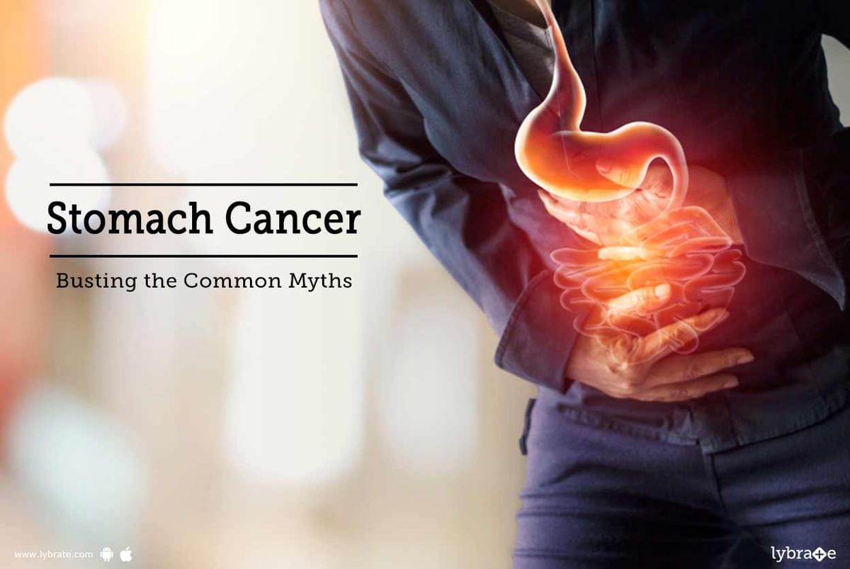 Stomach Cancer: Busting the Common Myths - By Dr. Garima | Lybrate