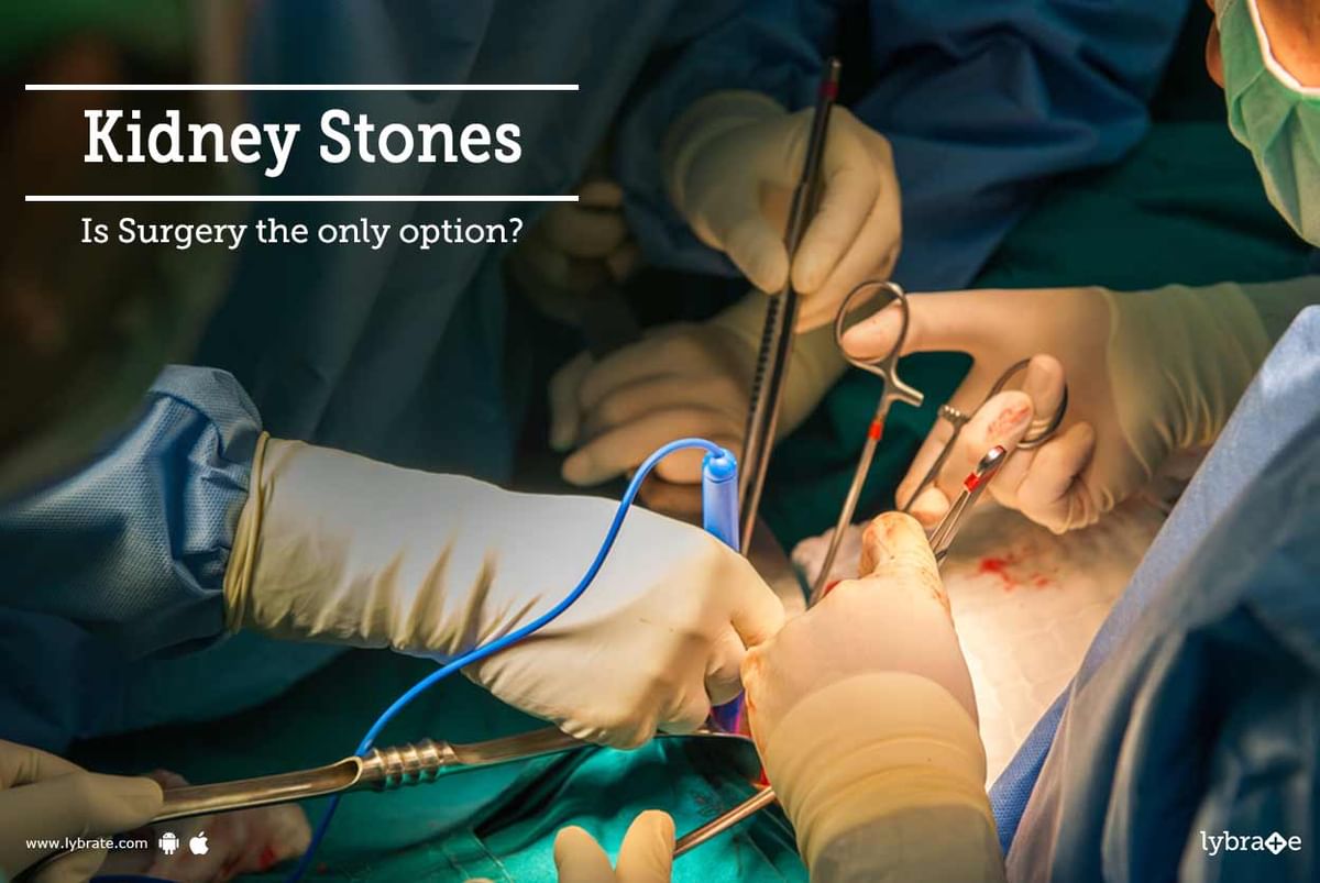 kidney-stones-is-surgery-the-only-option-by-dr-garima-lybrate