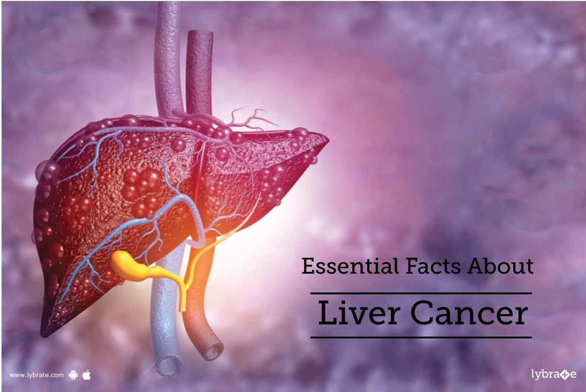 Essential Facts About Liver Cancer - By Dr. Garima | Lybrate