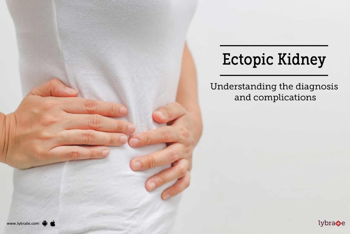 Ectopic Kidney Understanding The Diagnosis And Complications By Dr