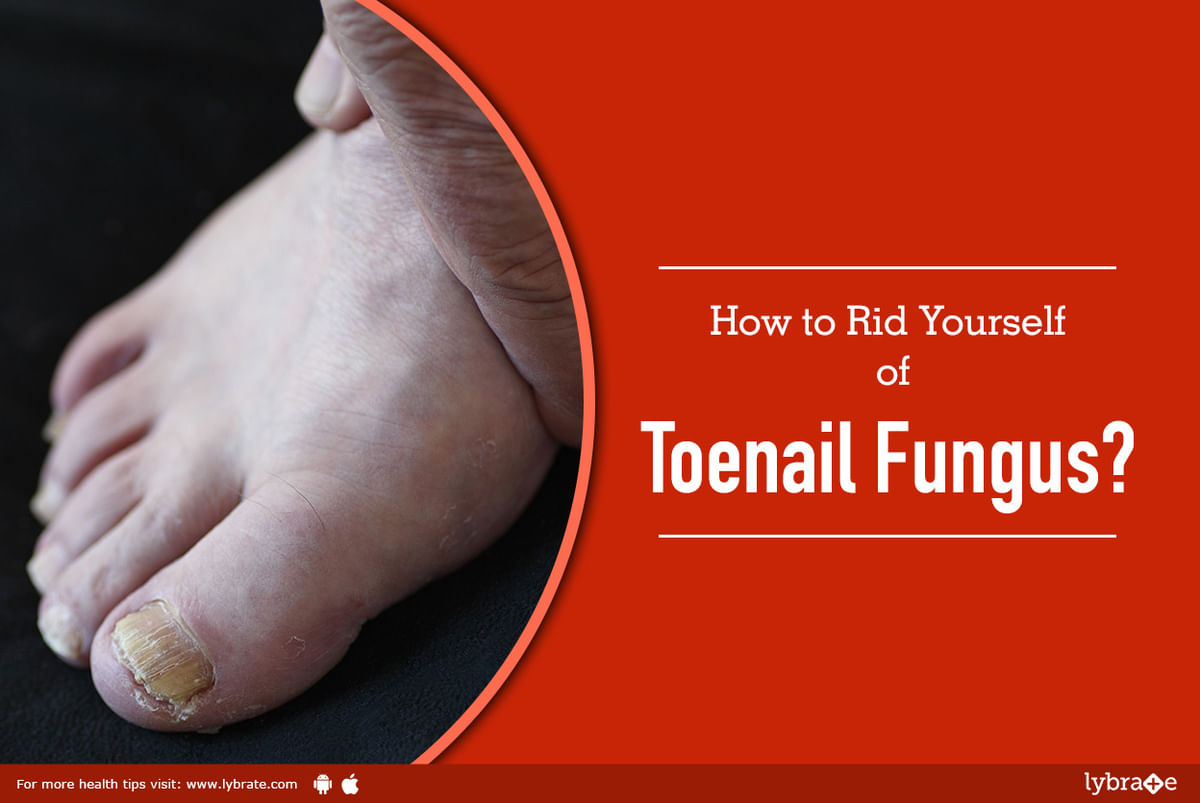 The Signs of Toenail Fungus: Are your feet infected?