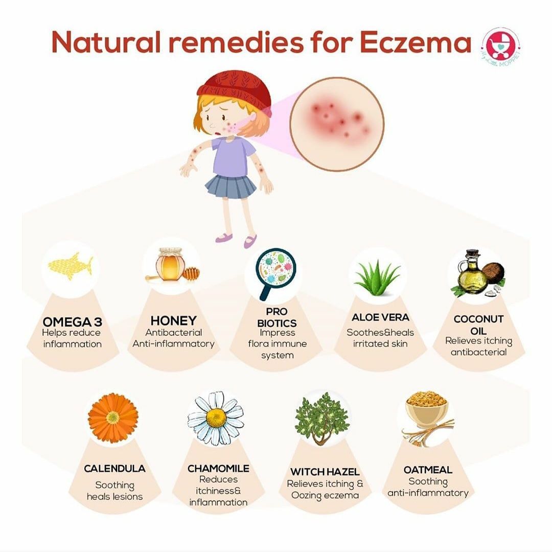Natural Remedies For Eczema Treatment! - By Dt. Neha Suryawanshi | Lybrate