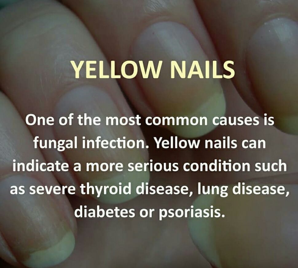 Health At Your Fingertips: What Your Nails Can Tell About Your Health