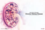 There are a few simple tips that you can follow to manage your chronic kidney disease and ensure ...