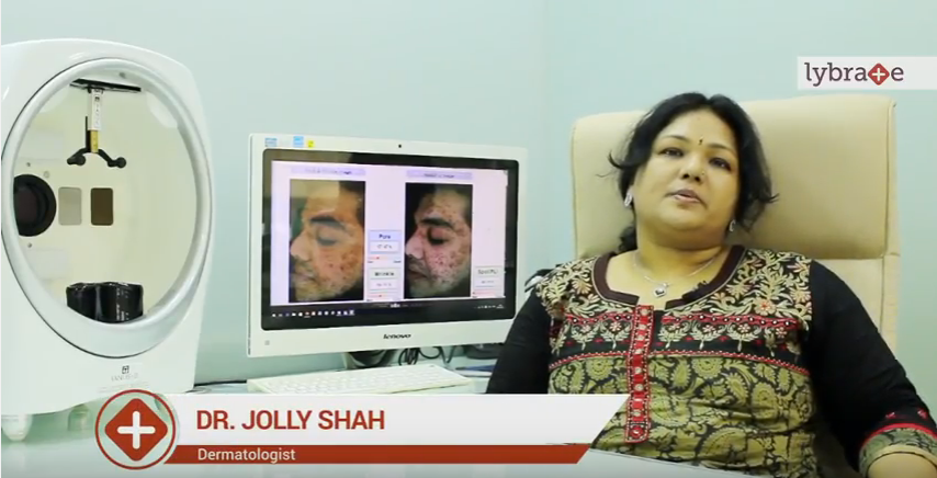 Causes and cosmetic treatment for Acne scars<br/><br/>Hello! I am Dr. Jolly Shah practicing Derma...