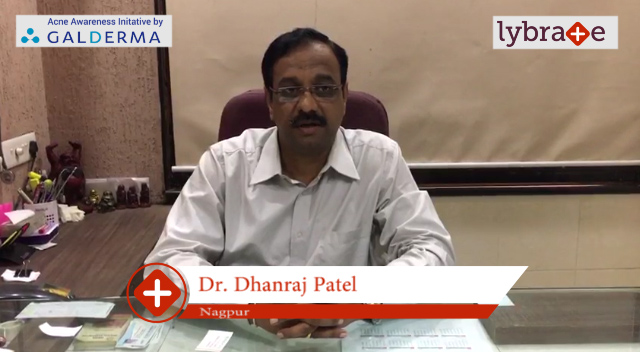 Lybrate | Dr. Dhanraj patel speaks on importance of treating acne early.