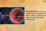 Hepatitis b - know more about it.