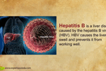 Hepatitis b is a liver disease caused by the hepatitis b virus (hbv).