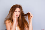 Know more about hair fall.