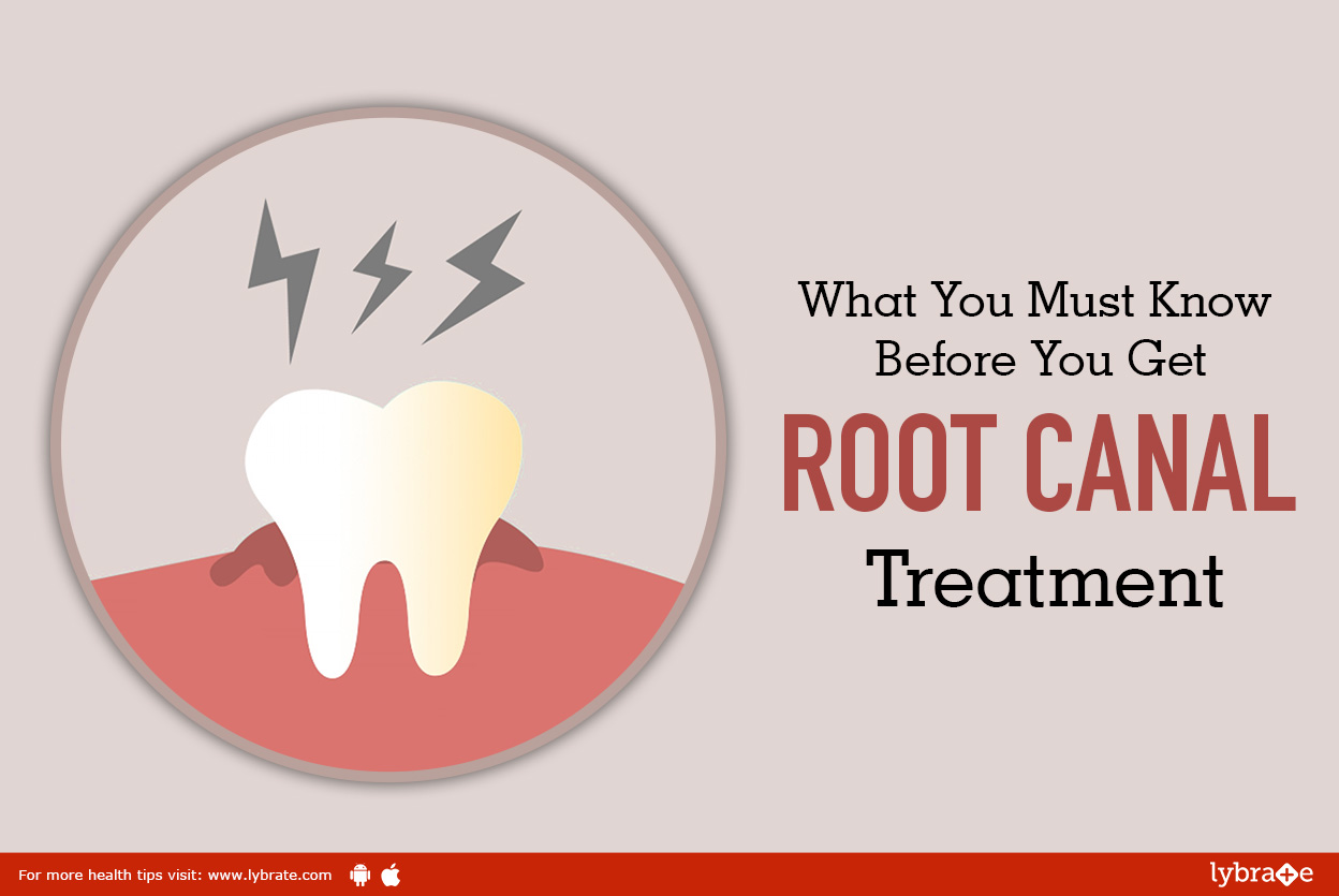 What you must know before you get root canal treatment<br/><br/>Root canal treatment also known a...