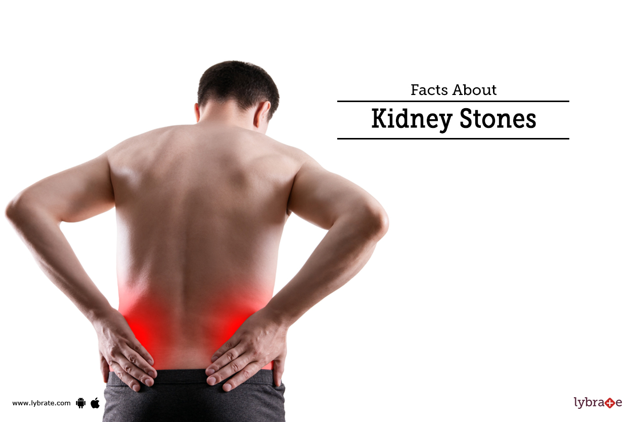 Understanding the various facts about kidney stones ;can help in preventing the kidney pain and l...