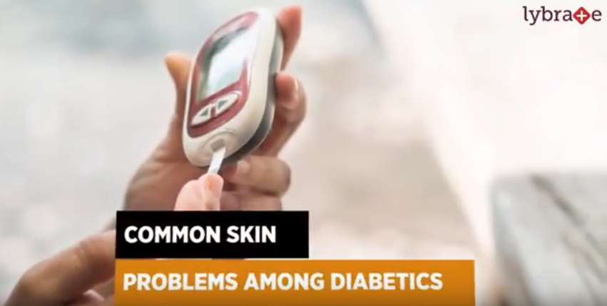 Skin problems related to diabetes are quite common and most diabetic people are likely to experie...