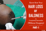How your hair loss or baldness is completely reversible (non-surgically)<br/><br/>Having deeply r...