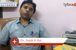 Lybrate | Dr. Anish k. Rai speaks on importance of treating acne early.