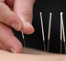 Dr.Hr Bansal - Acupuncturist, Delhi GURGAON