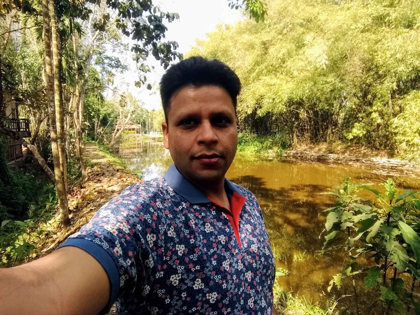 Dr.U Venkata Krishna Rao - Diabetologist, Bangalore