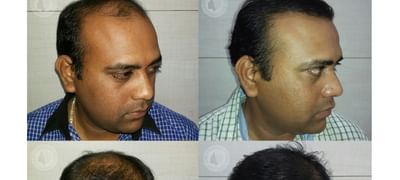 Hair Harmony and You in G S RoadGuwahati  Best Hair Loss Doctors in  Guwahati  Justdial