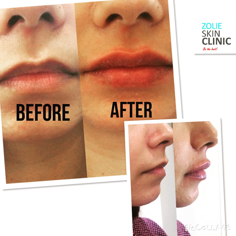 zolie skin clinic near me