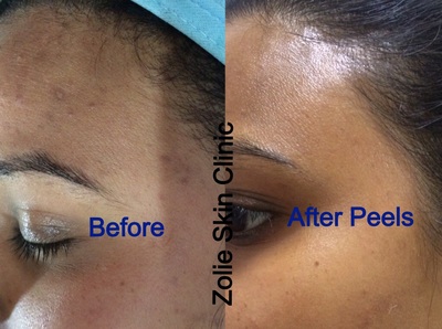 zolie skin clinic near me