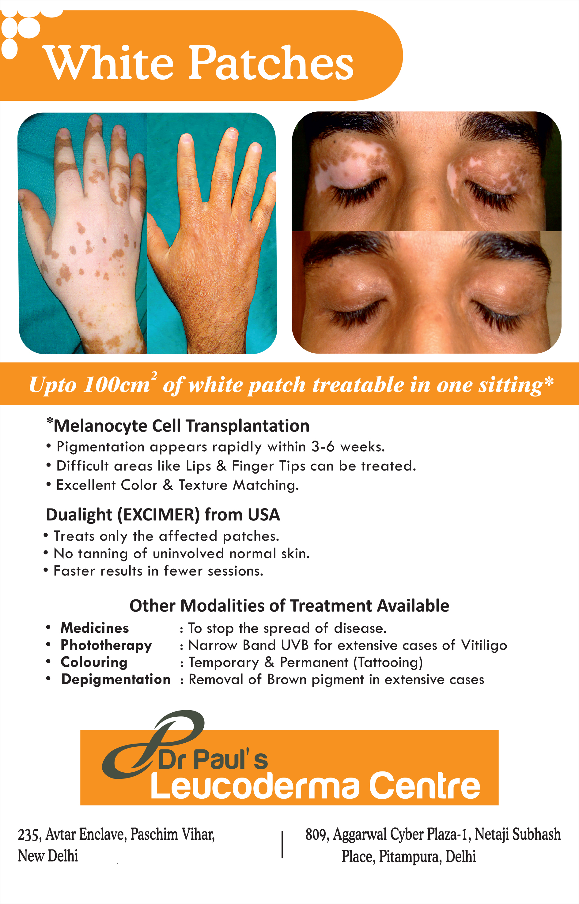 Paul's Leucoderma Centre Image 1