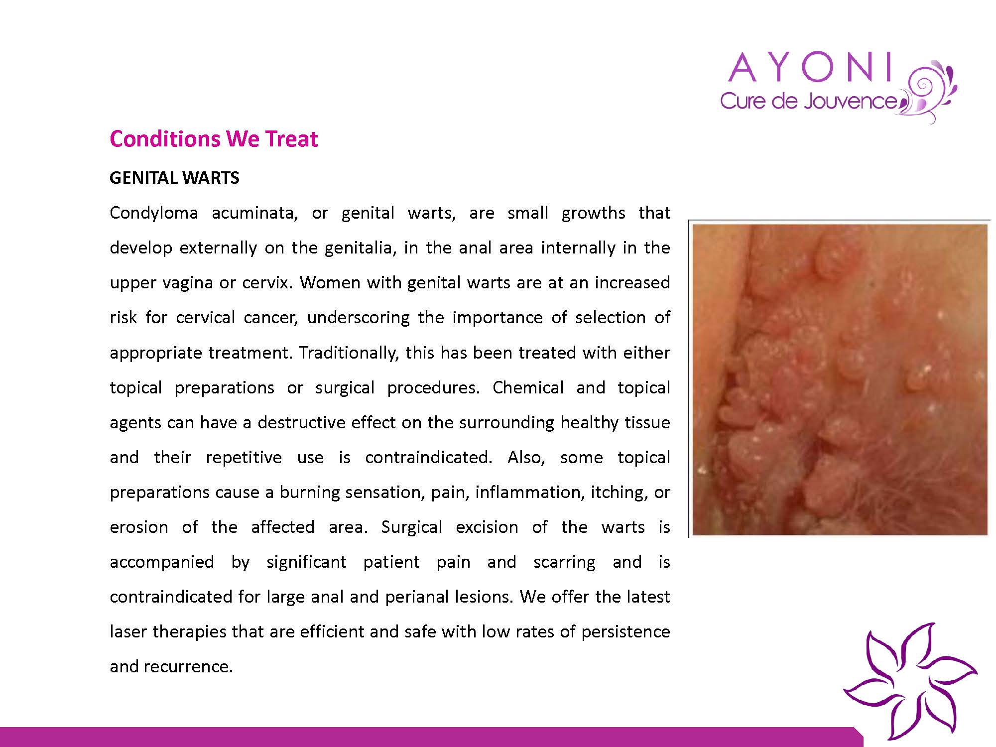 Ayoni Cure De Jouvence Image 8