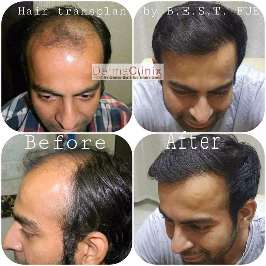 Dr. Kavish Chouhan - Book Appointment, Consult Online, View Fees, Contact Number, Feedbacks | Dermatologist in Delhi Dr. Kavish Chouhan - Book Appointment, Consult Online, View Fees, Contact Number, Feedbacks | Dermatologist in Delhi