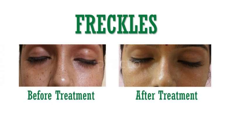 Dr.  - Book Appointment, Consult Online, View Fees, Contact  Number, Feedbacks | Dermatologist in Chennai