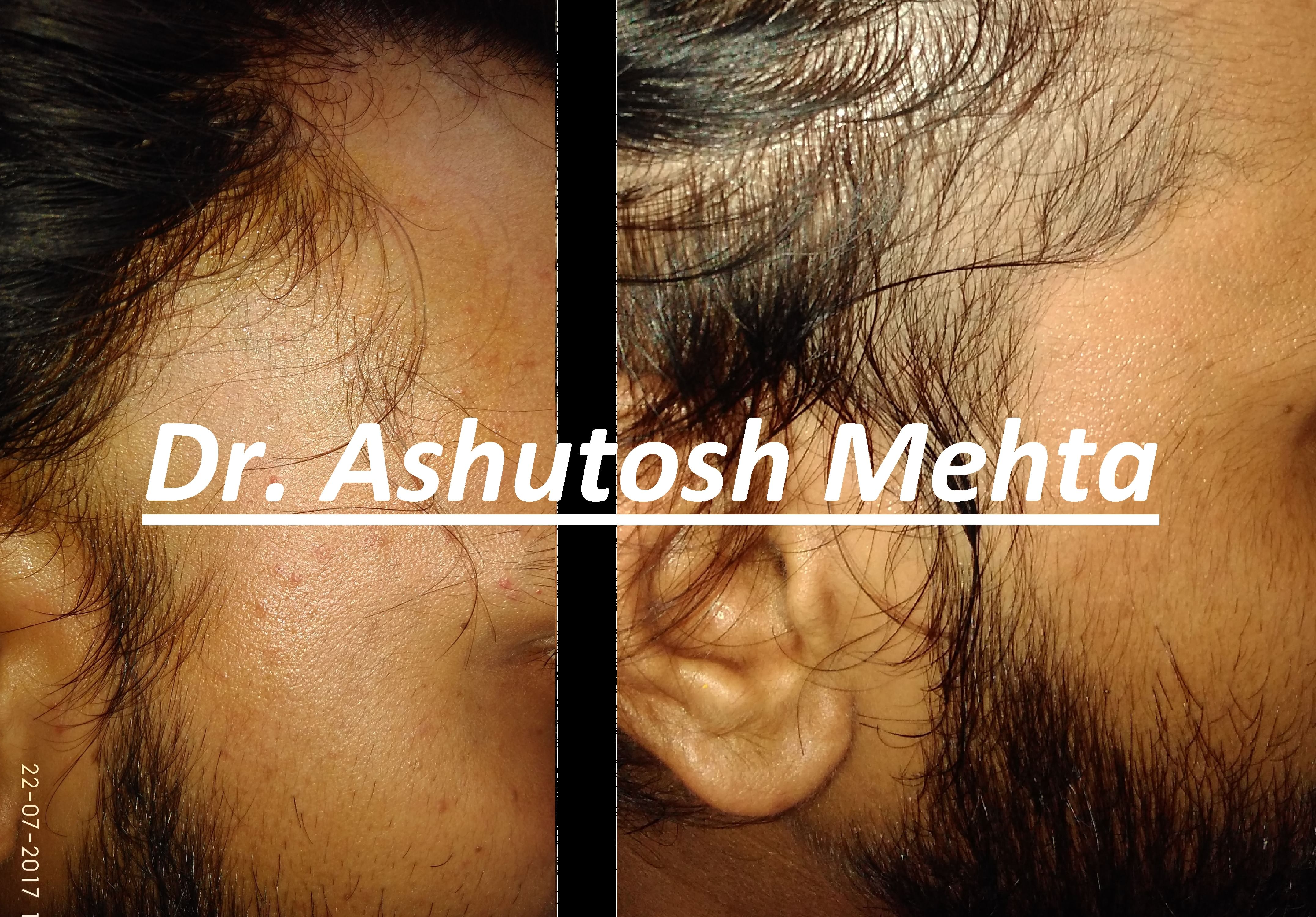 Dr. Ashutosh Mehta - Book Appointment, Consult Online, View Fees, Contact  Number, Feedbacks | Dermatologist in Nagpur