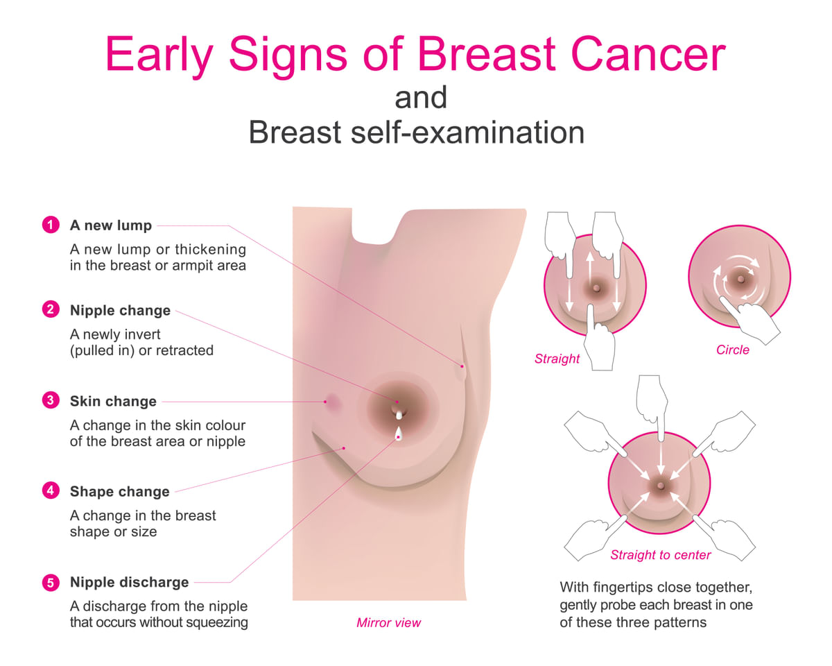 Breast Cancer: Procedure,Surgery, Recovery, Cost and Side Effects