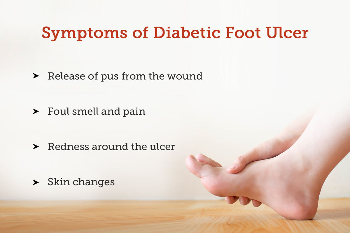 Diabetic Foot Ulcer: Symptoms, Causes, Treatment and Cost
