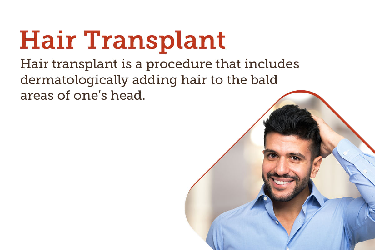 Hair Transplant: Treatment, Procedure, Cost, Recovery, Side Effects And More