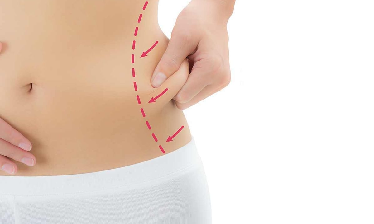 Reduce Unwanted Fat Pockets with Liposuction in New Orleans