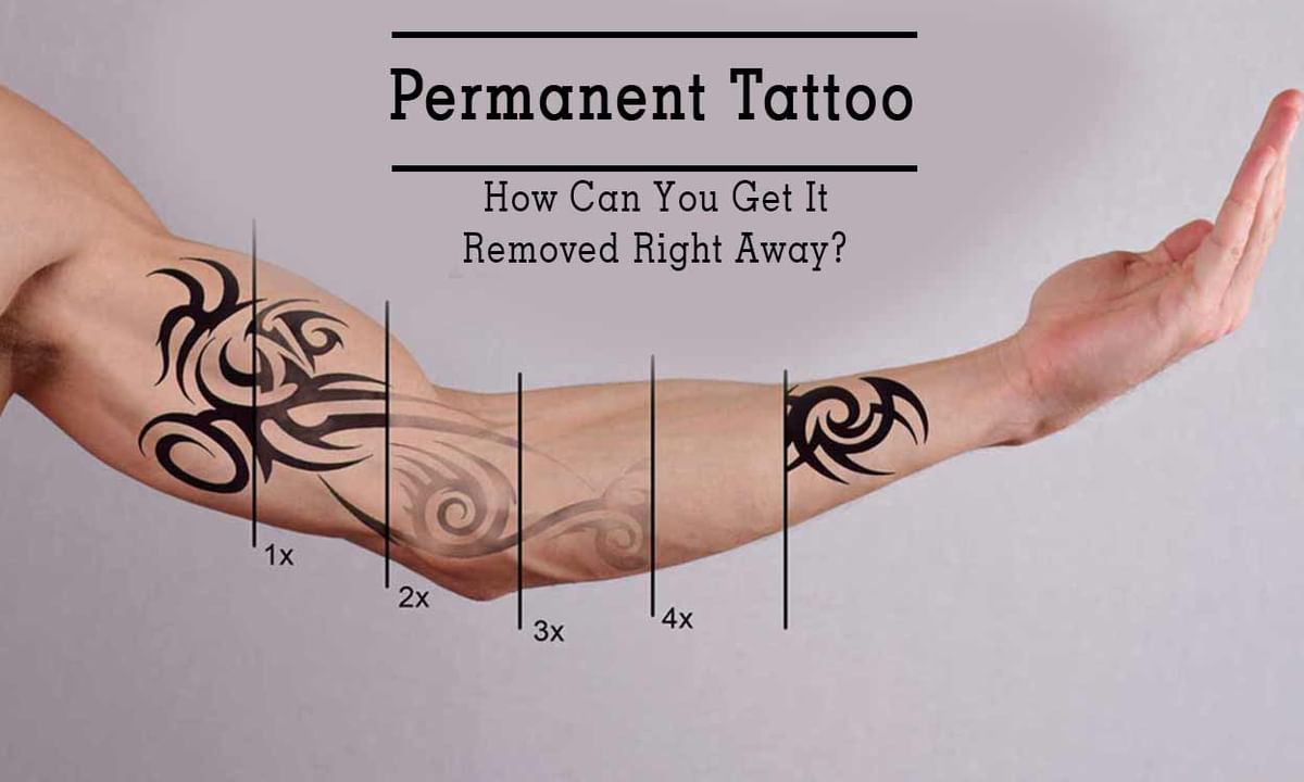 How Effective is Laser Tattoo Removal  Laser Specialists