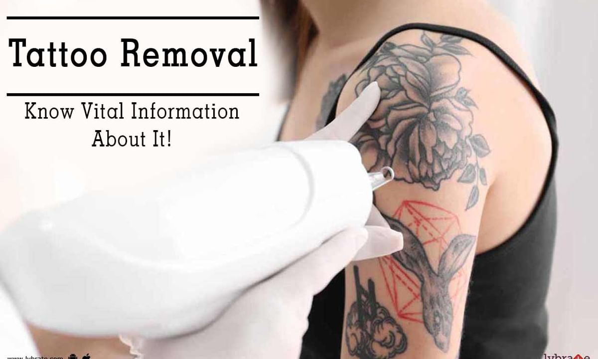 Different Ways To Remove Permanent Tattoo Easily  Styles At Life