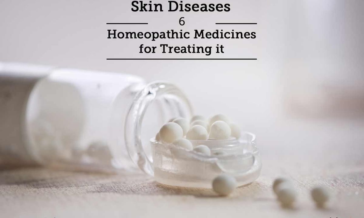Skin Diseases - 6 Homeopathic Medicines for Treating it - By Dr. Greeva  Mankad | Lybrate