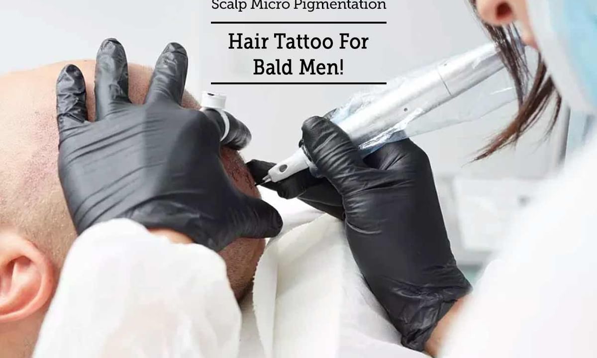Scalp Micro Pigmentation - Hair Tattoo For Bald Men! - By Dr. Rupinder Kaur  | Lybrate