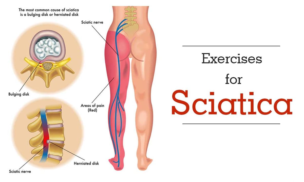 Best 3 Simple Stretches For Sciatica Dr Vipin Garg Gwalior 1108